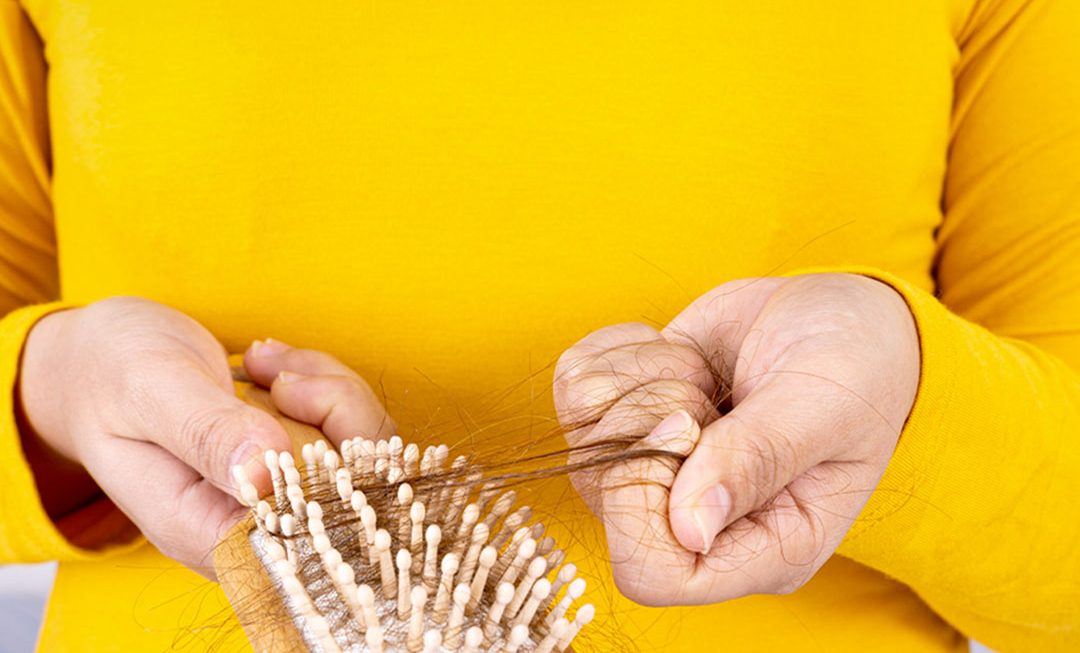 O papel das vitaminas e minerais na queda de cabelo – Parte 1