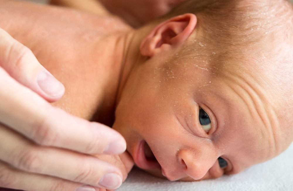 Associação entre fenótipos de nascimento prematuro, morbidade, crescimento e neurodesenvolvimento
