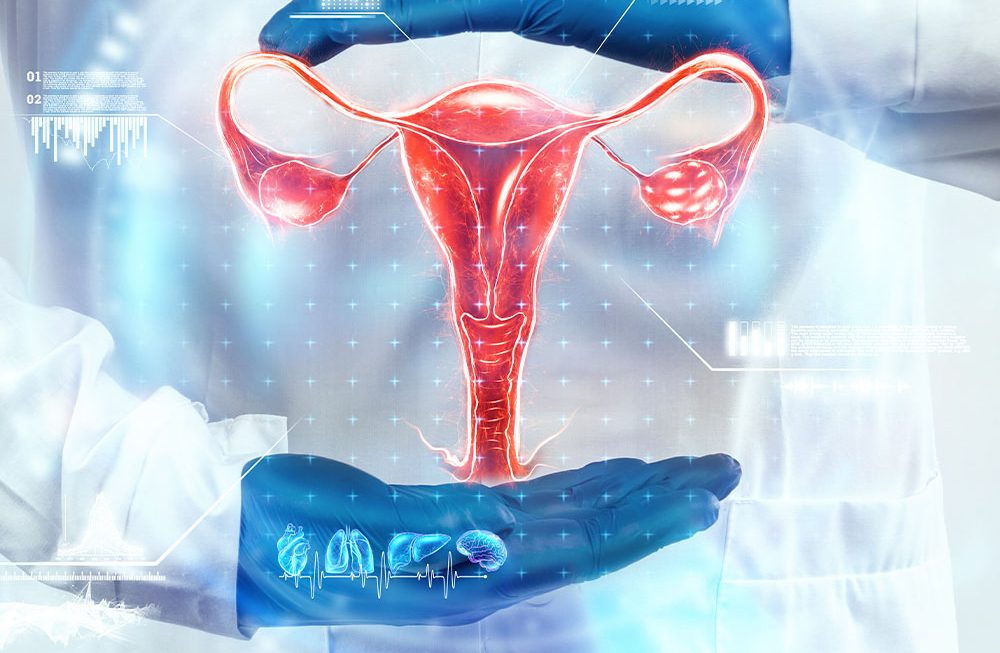 A importância da Nutrição no tratamento da SOP e endometriose