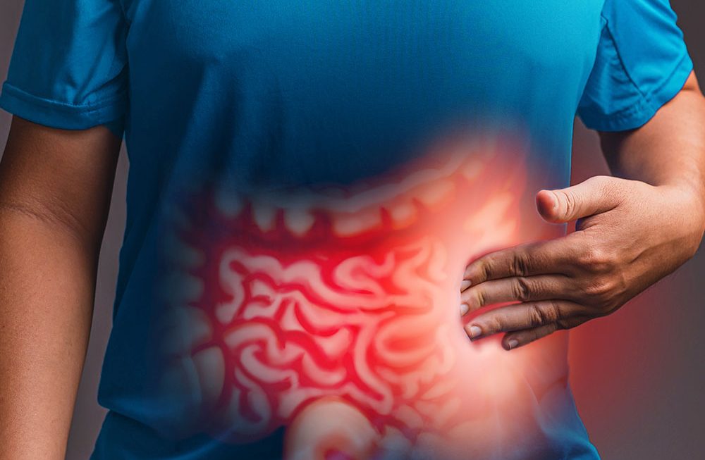 Doenças inflamatórias intestinais