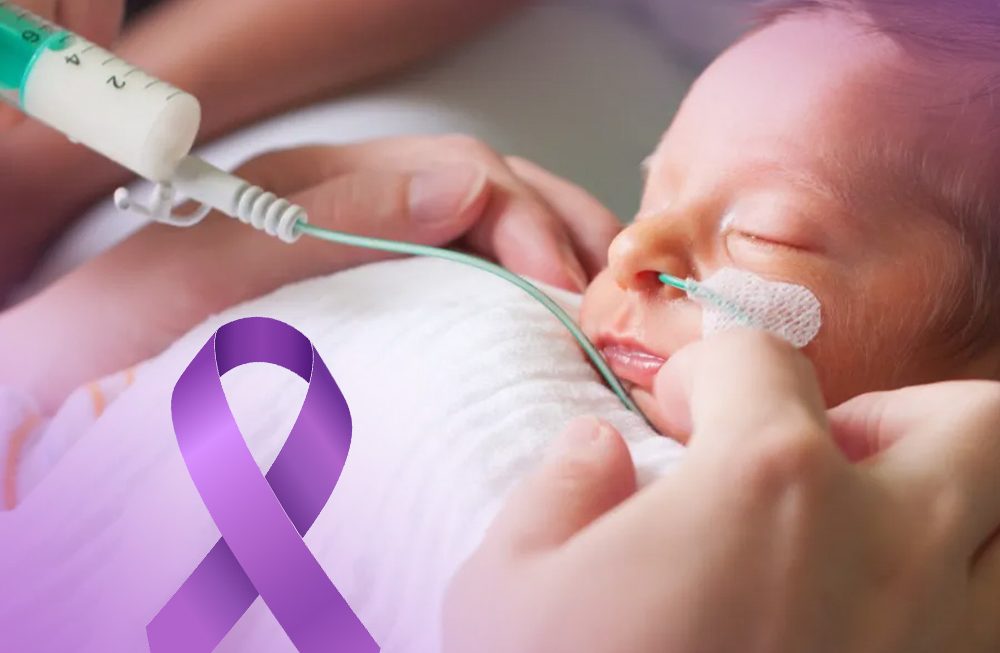 Cuidados e alimentação no manejo do bebê prematuro