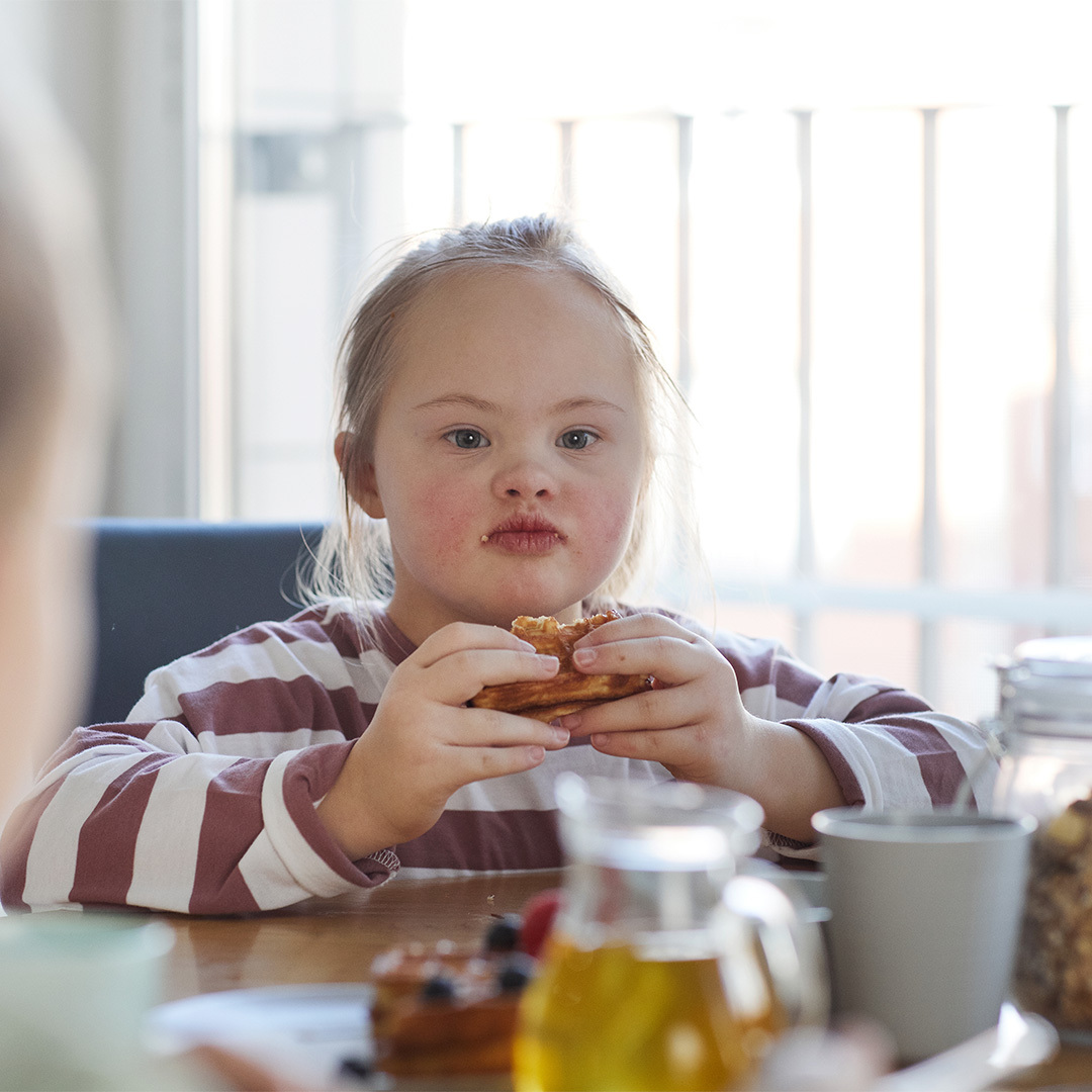Acompanhamento nutricional na síndrome de Down