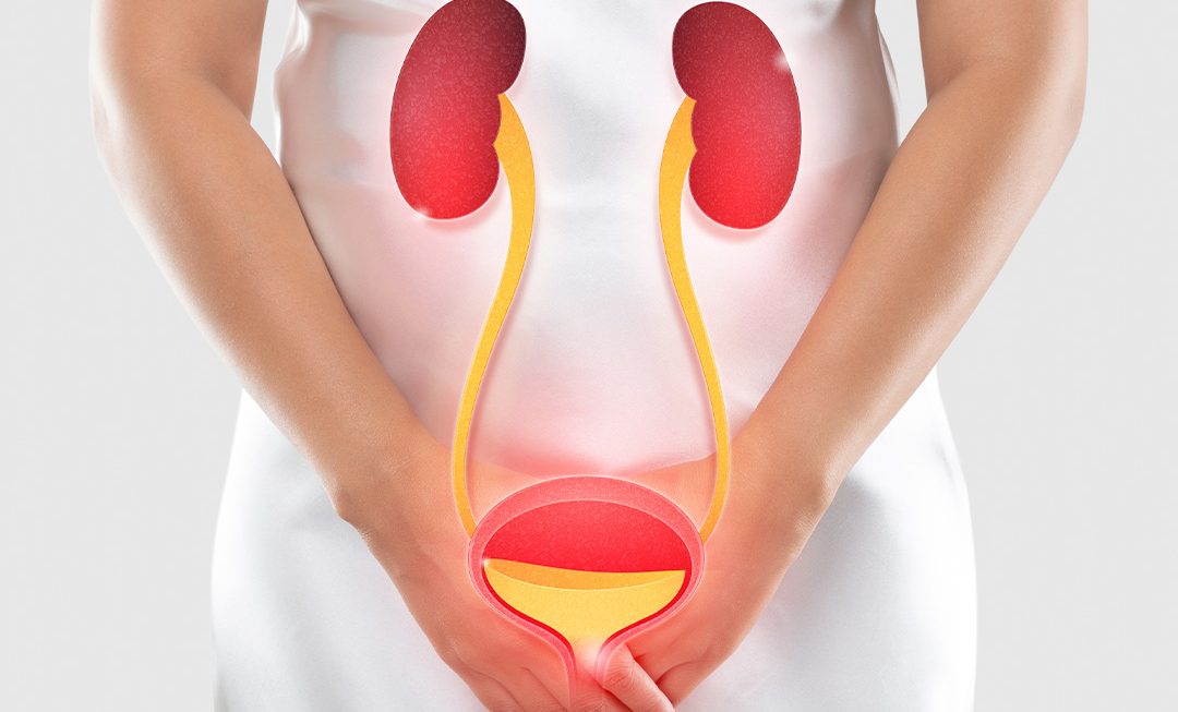 Infecção urinária feminina: como a nutrição pode ajudar