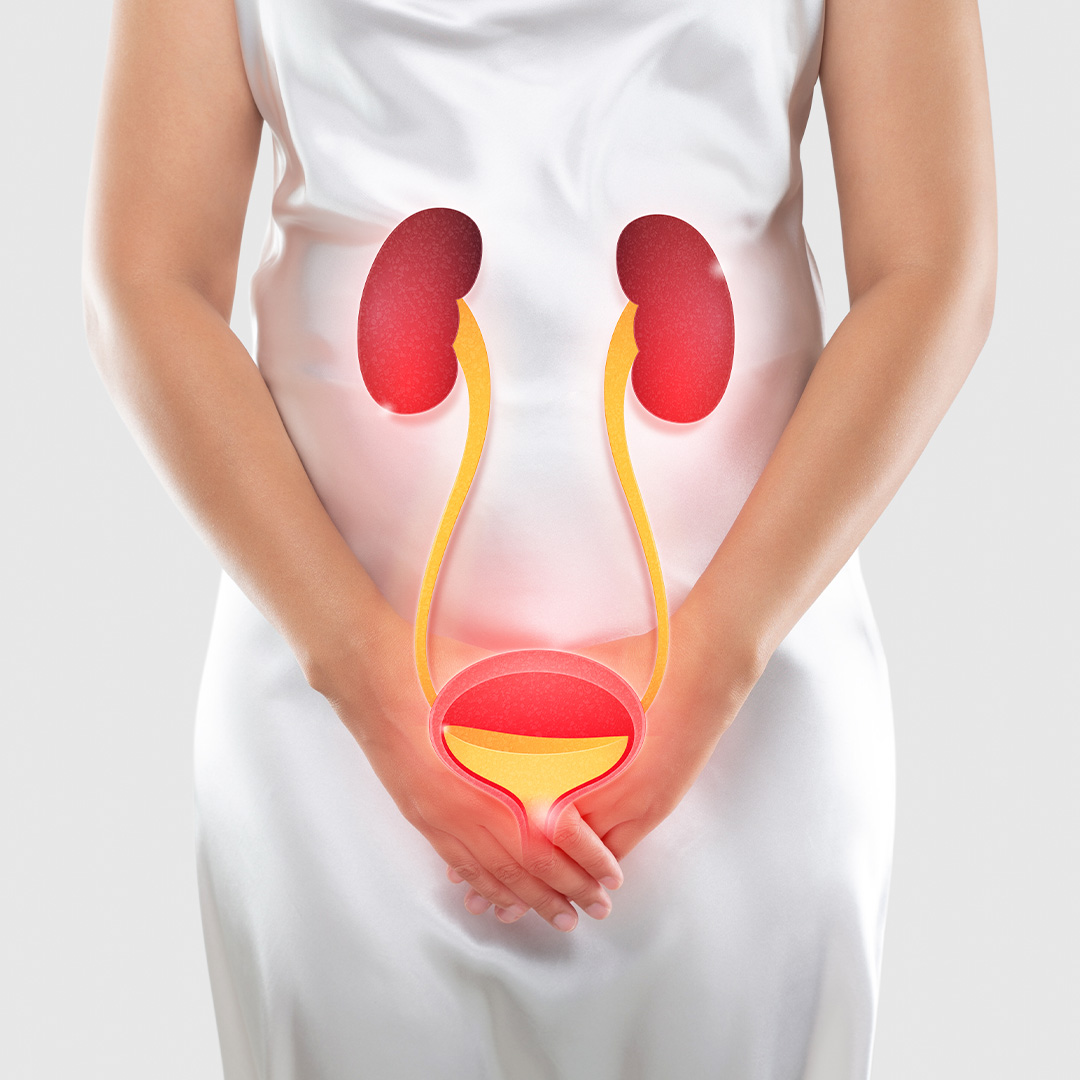 Na imagem, uma ilustração do sistema urinário, indicando infecção urinária